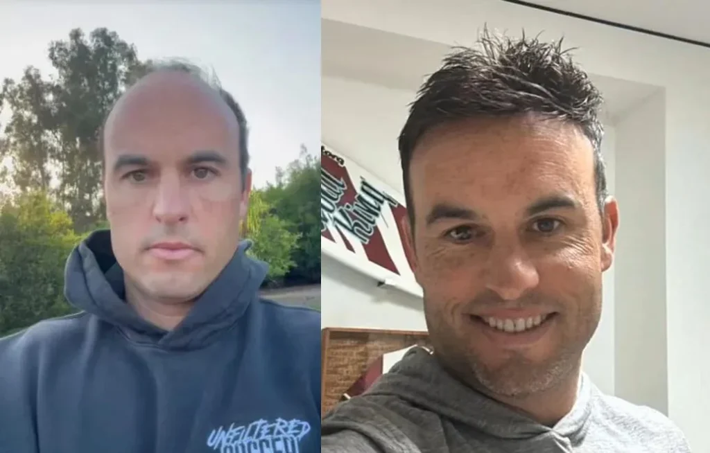Landon Donovan Hair 7